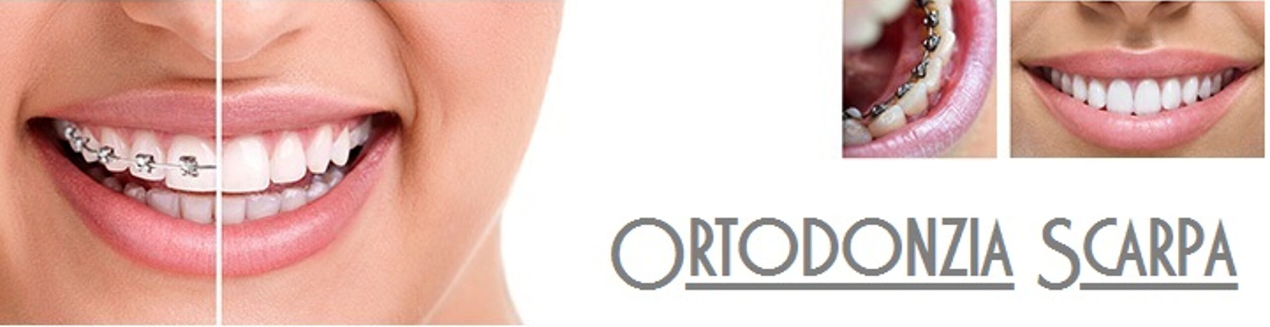 Ortodonzia
